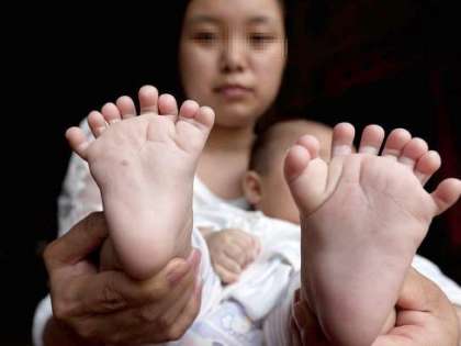 900,000 Chinese babies born with birth defects annually 900,000 Chinese babies born with birth defects annually