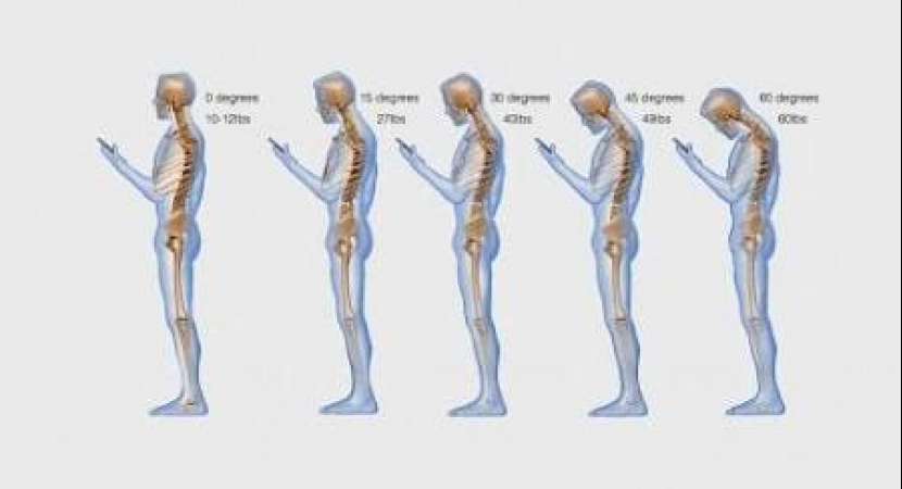 Tips: How to prevent text neck Tips: How to prevent text neck