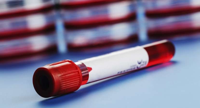 Novel blood test to identify premature birth, says Study Novel blood test to identify premature birth, says Study