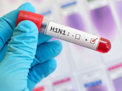 Swine flu is caused by one of the swine influenza viruses (SIV) and H1N1 strain is most common across India Swine flu is caused by one of the swine influenza viruses (SIV) and H1N1 strain is most common across India
